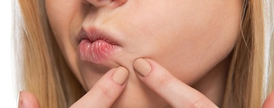 Jak pozbyć się ropnych pryszczy na twarzy?